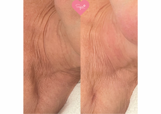 Tight Neck Energy PROMO